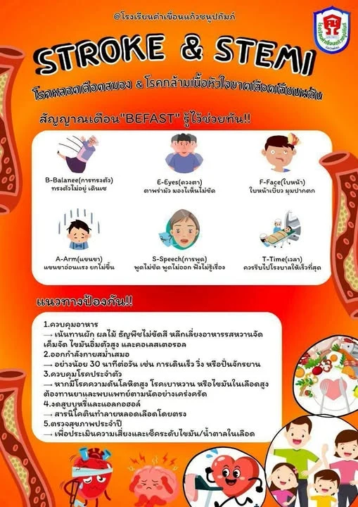 โรคหลอดเลือดสมองและโรคกล้ามเนื้อหัวใจขาดเลือดเฉียบพลัน